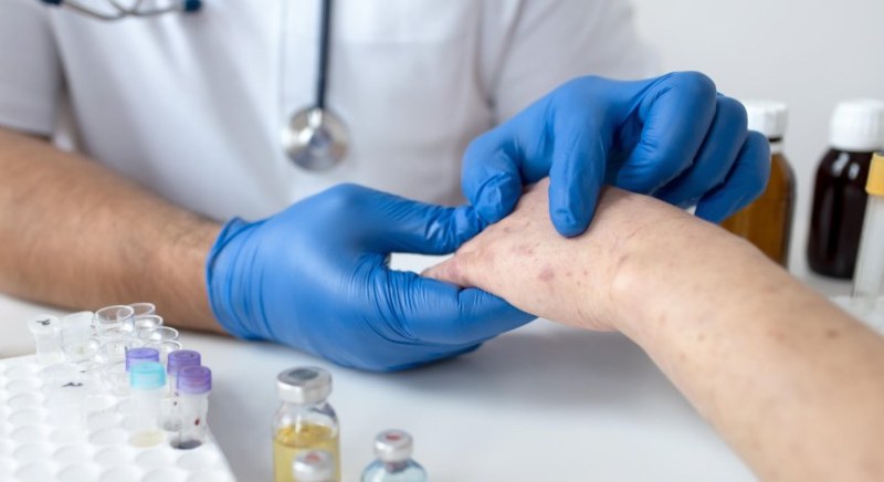 Проф. Андрей Чорбанов: Морбили изтрива имунната памет, започвате от нулата!