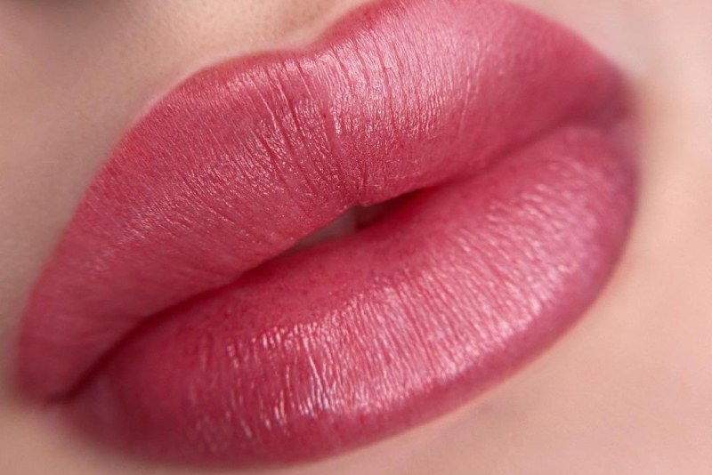 Майки и дъщери с нови устни преди баловете, лекари предупреждават в Пловдив за опасни корекции