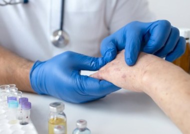 132 са вече случаите на морбили у нас