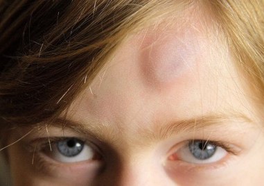 МЗ с препоръки към лекарите при съмнение за домашно насилие